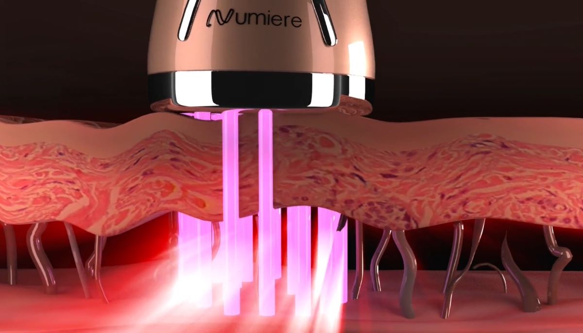 Numiere Microcurrent & LED Tightening Sculpting & Wrinkle Reducing Device Detail