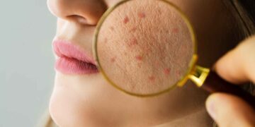 Primark cutis cuidado piel