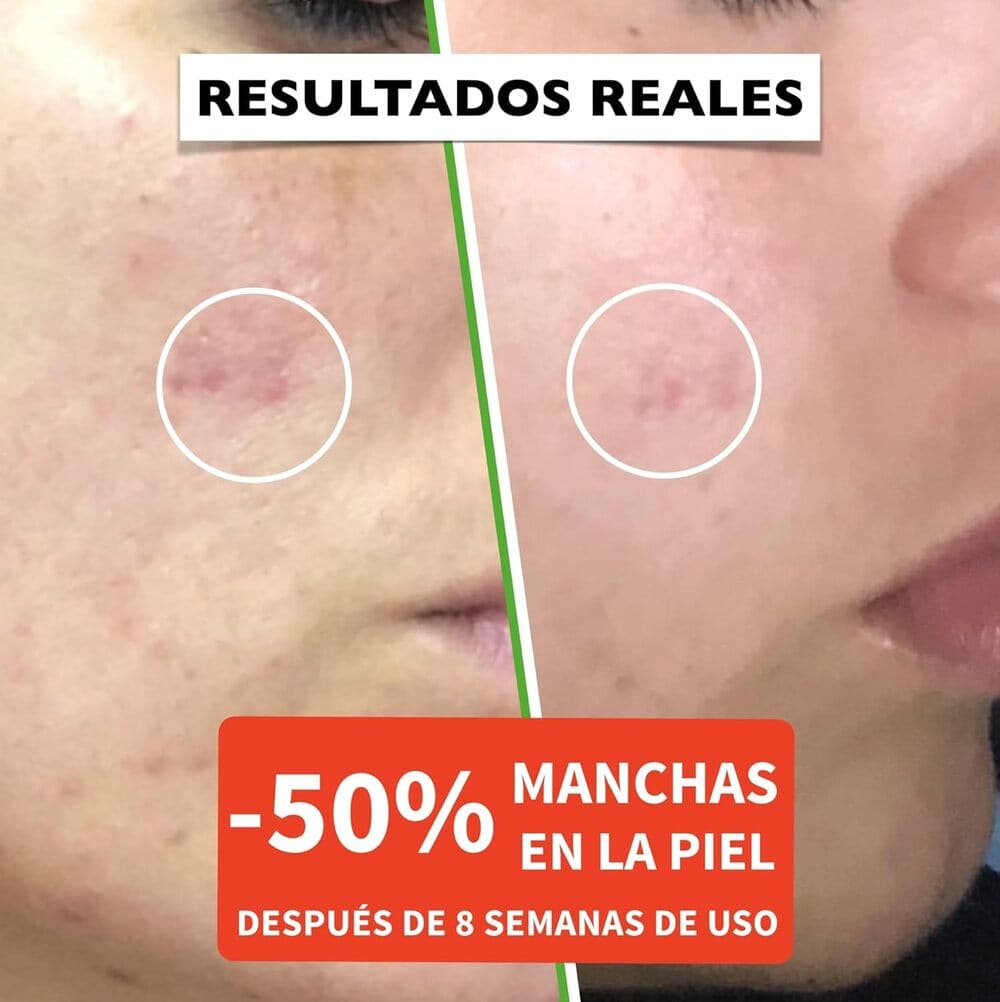 Amazon Bio Sérum Facial con Vitamina C, E y Ácido Hyalurónico