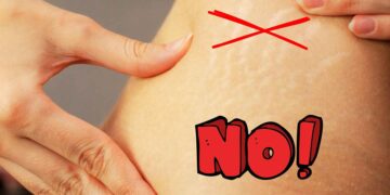 Amazon crema antiestrías