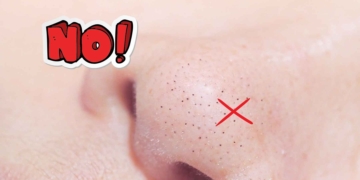 Carrefour limpiador facial puntos negros