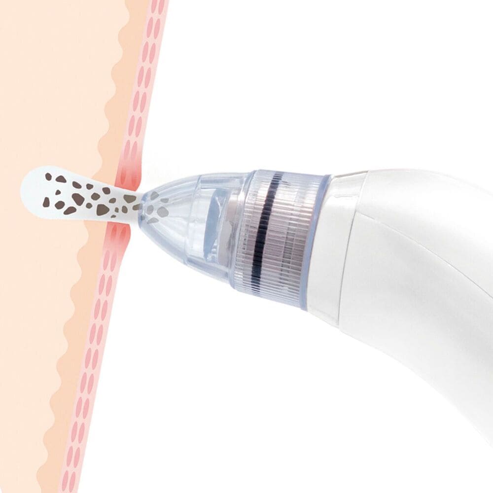 Limpiador Facial Eléctrico De Puntos Negros Pore·off Innovagoods